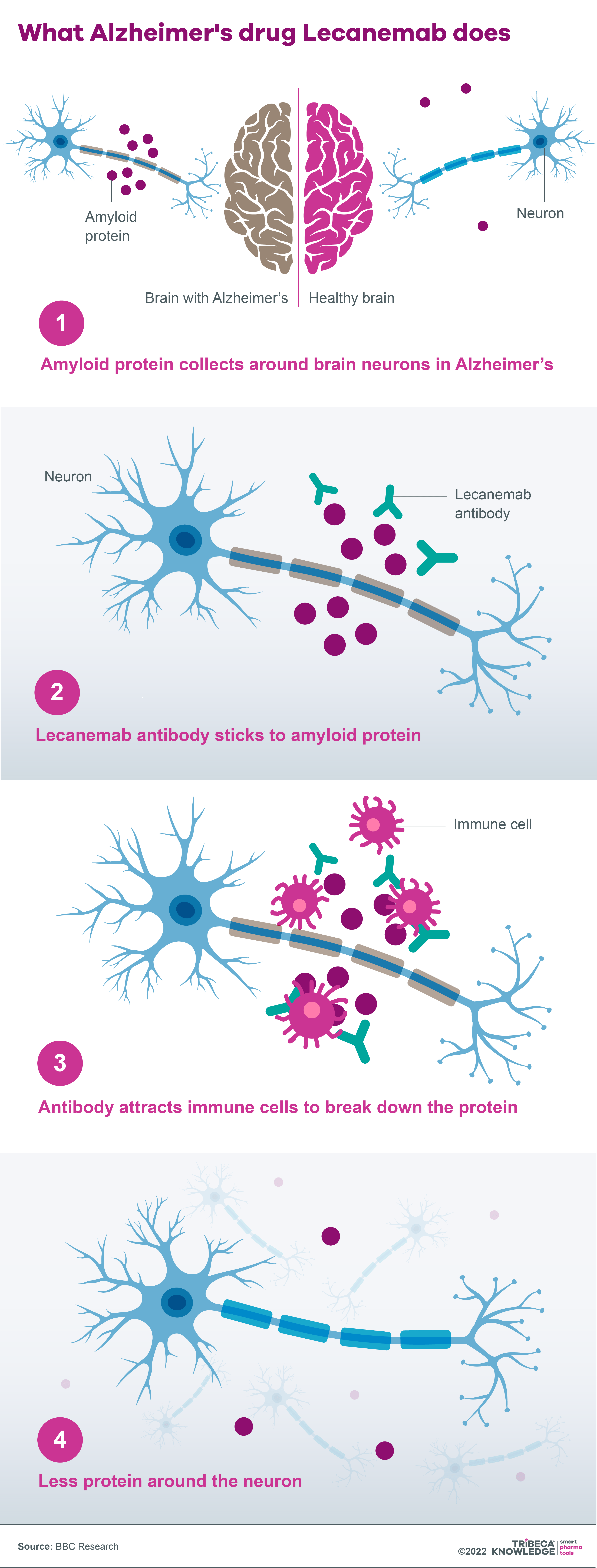 Illustration showing how the Alzheimer's drug lecanamab works